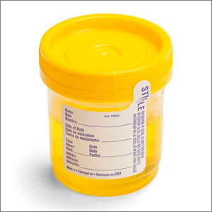 A yellow container with a lid, suitable for storing samples for tests- Moss Bollinger LLP