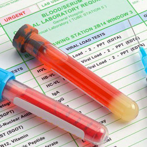 Blood samples on a medical form: A form with labeled vials containing blood samples for medical testing- Moss Bollinger LLP